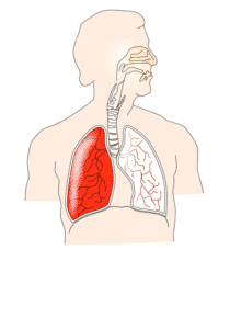 cannabis-santé pulmonaire